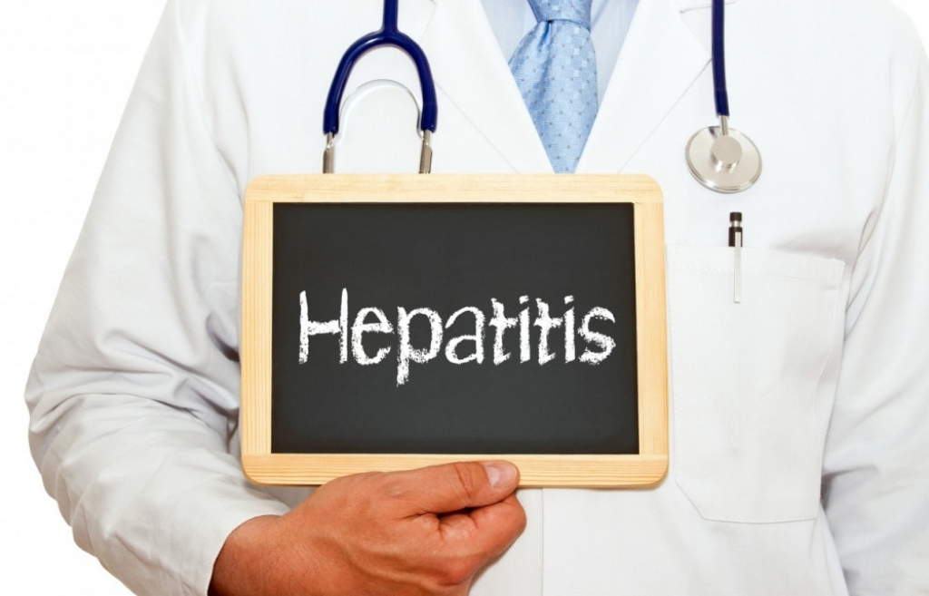 Hepatitis, žutica