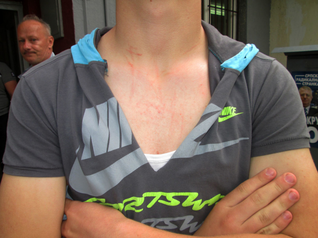 Napadnut aktivista SRS: Dečaku pokidana majica i izgreban vrat