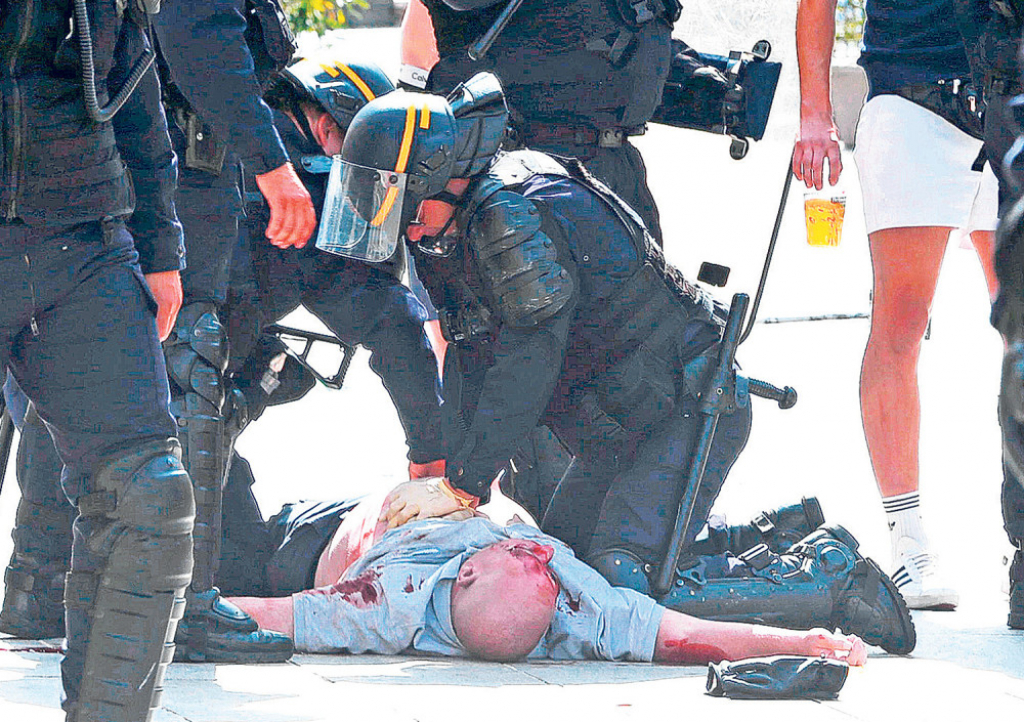 Trenutak kada Martin radi masažu srca Endiju