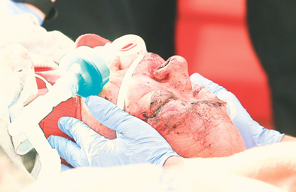 Englez je doživeo infarkt i teške povrede glave: Endi Bač