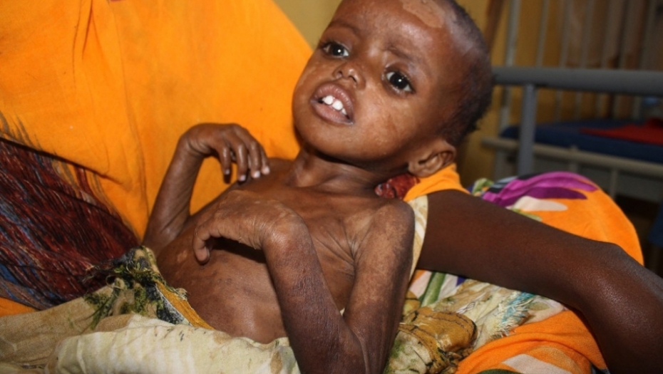 Somalija Glad