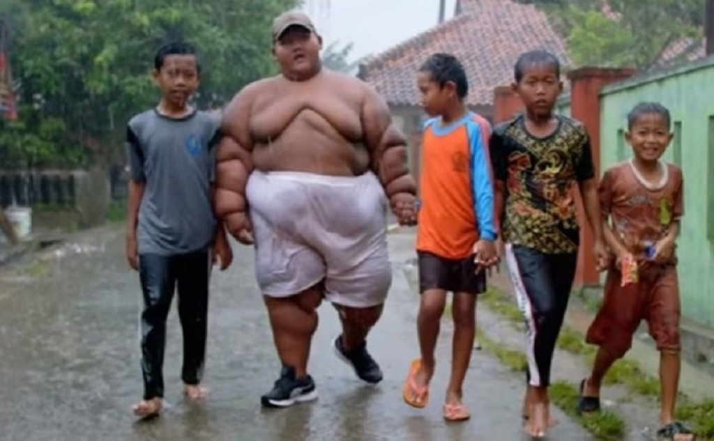 Najdeblje dete na svetu Arja Perman