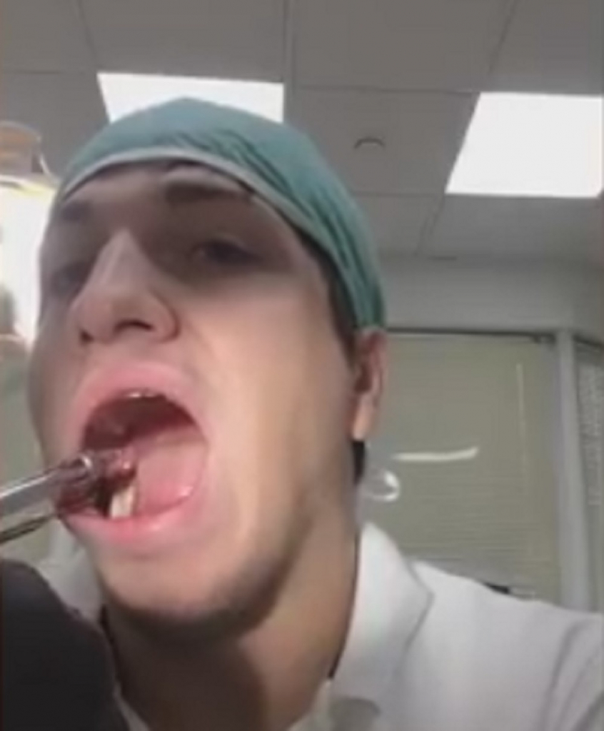 Ruski zubar sam sebi izvadio zub