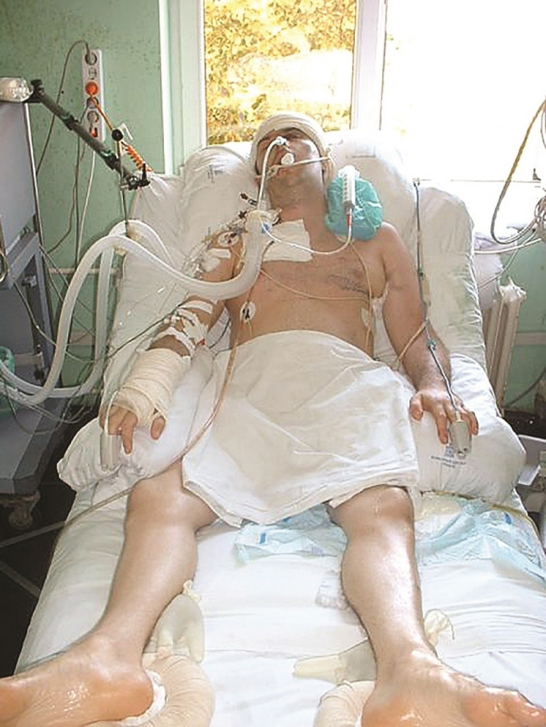 Bris Taton je preminuo posle nekoliko dana u bolnici