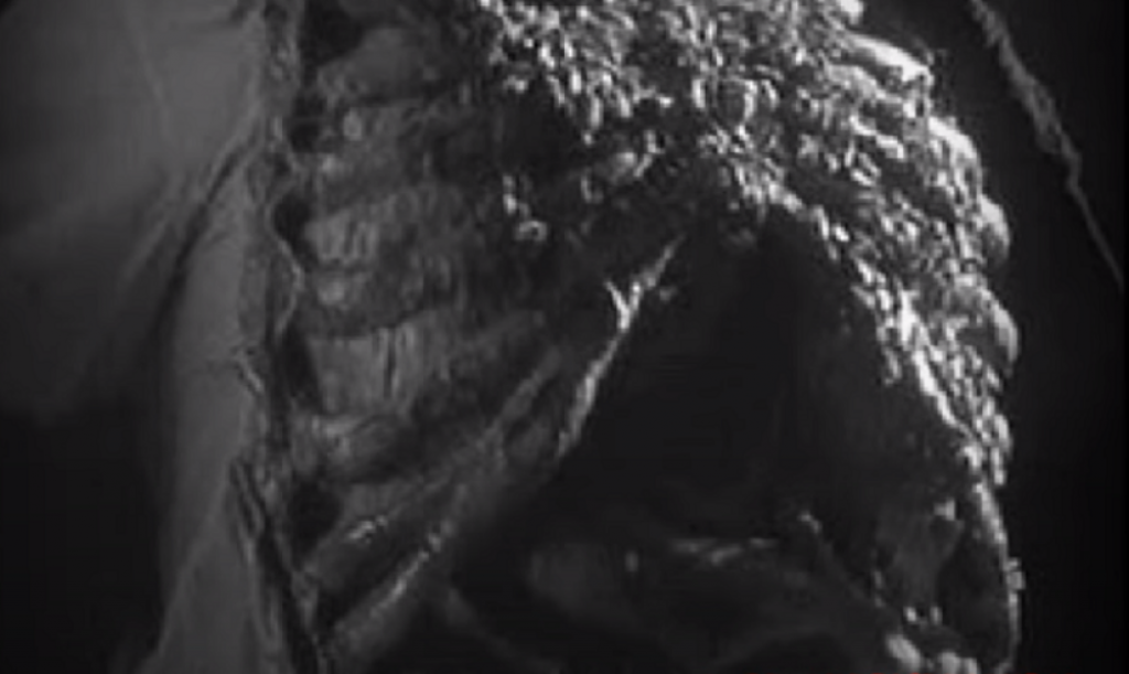 Pluća su se videla kroz rebra