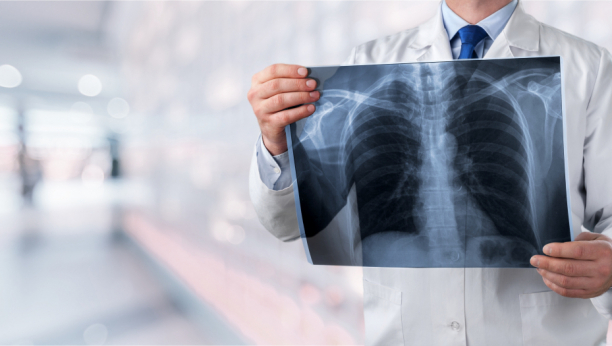 Otkrivanje bolesti pluća