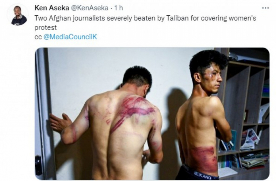 (UZNEMIRUJUĆE FOTOGRAFIJE) BRUTALNO MUČENJE NOVINARA Talibani unakazili nesrećne ljude!