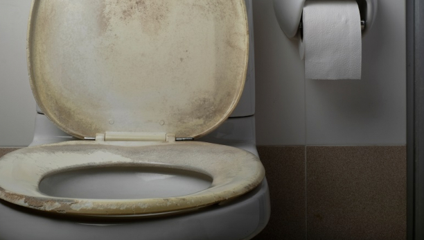 TRIK KOJI SVAKA DOMAĆICA MORA DA ZNA Kako ukloniti žute mrlje sa toaletne daske uz pomoć samo jednog proizvoda iz kuhinje