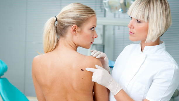 ZAŠTITITE SE NA VREME Kako da prepoznate prve simptome malignih promena na koži