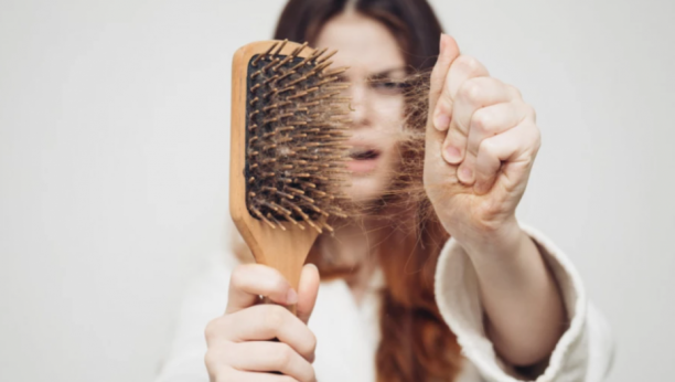REŠITE PROBLEM NA VREME Ovo je najčešći uzrok opadanja kose