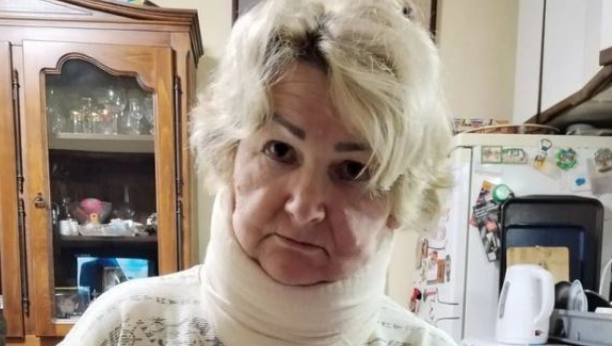 NISAM ZNALA ŠTA ME SNAŠLO, SVE ZVEZDE SAM VIDELA Oglasila se Snežana (60) koja je brutalno pretučena na maloj pijaci na Karaburmi