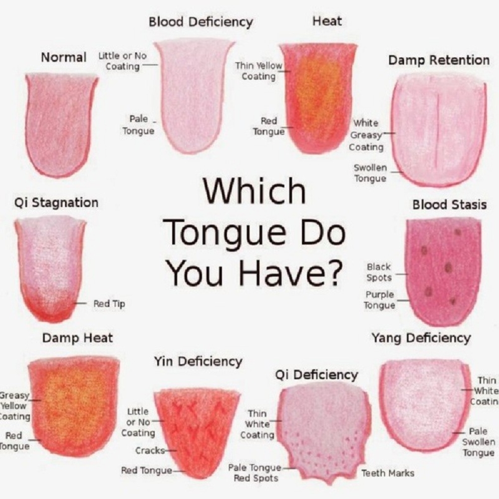 Bolesti jezika