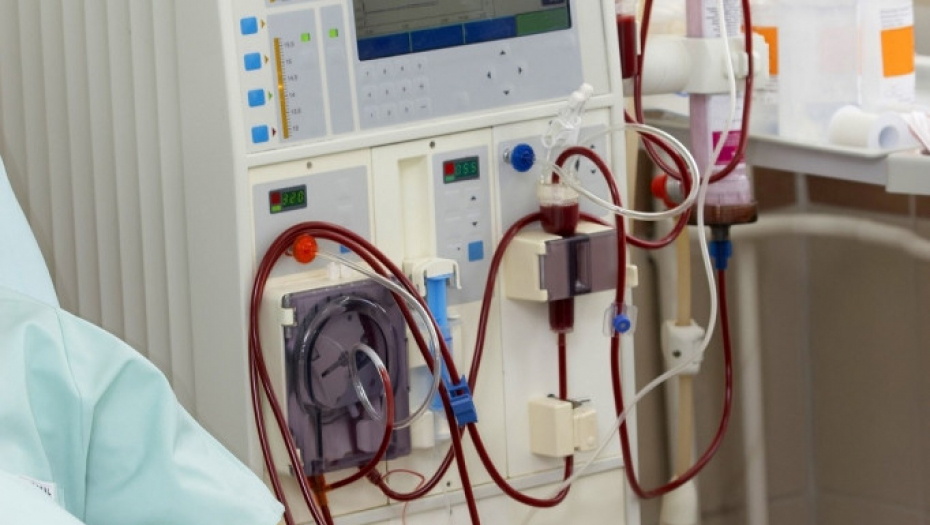 Dijaliza bubrega