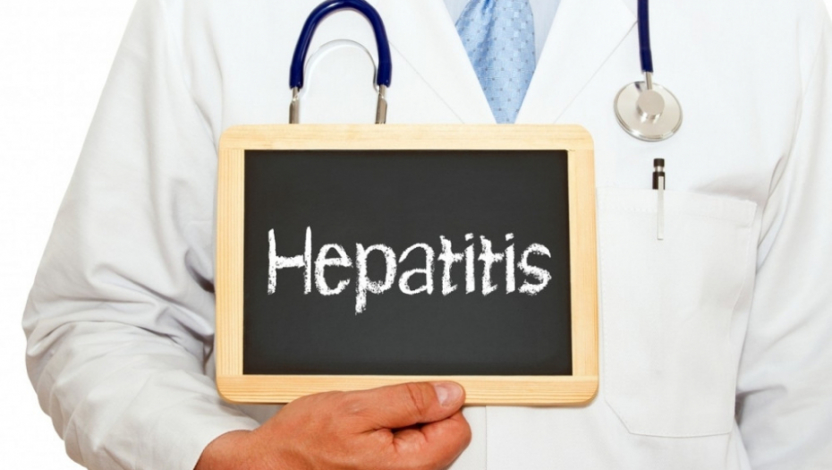 Hepatitis, žutica