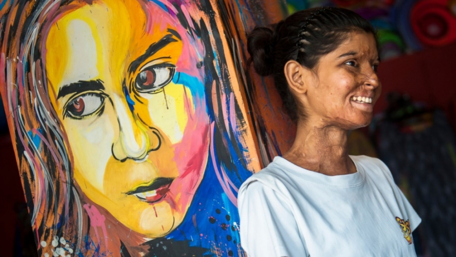 Žrtve napada kiselinom u indiji