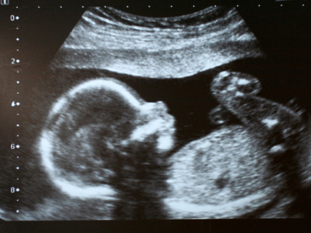 Beba, ultrazvuk
