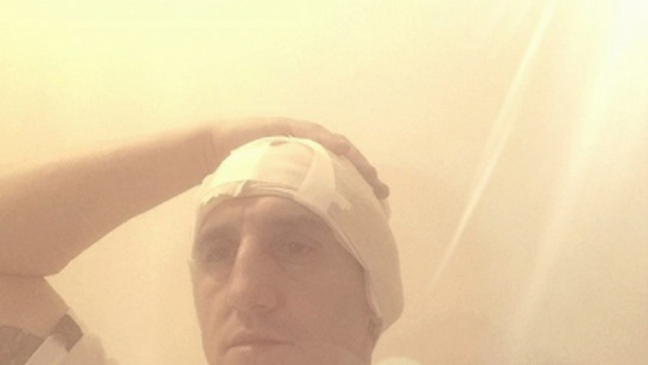 Kristijan posle operacije glave