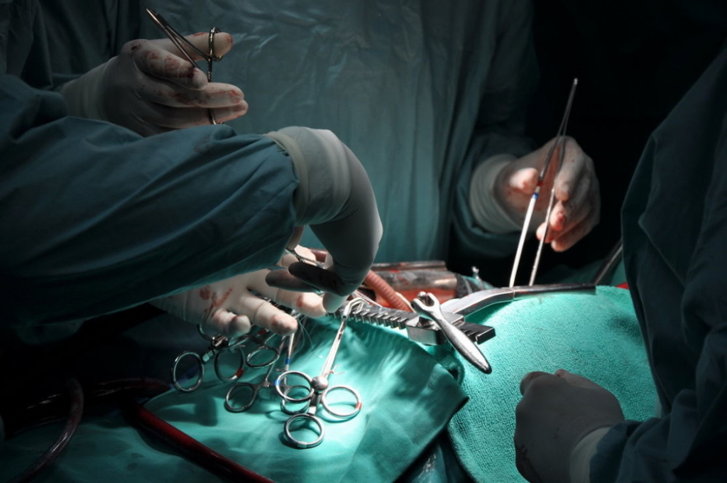 Operaciona sala srce