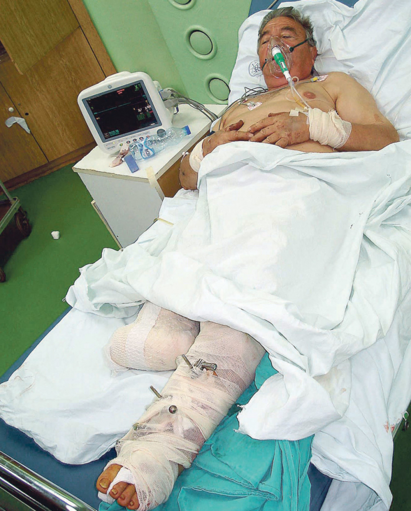 Jedva izvukao živu glavu:  Zoran To&scaron;ić