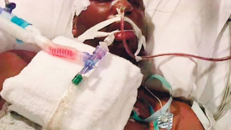 Ovako je  nesrećni Odom  izgledao  dok je bio  u komi