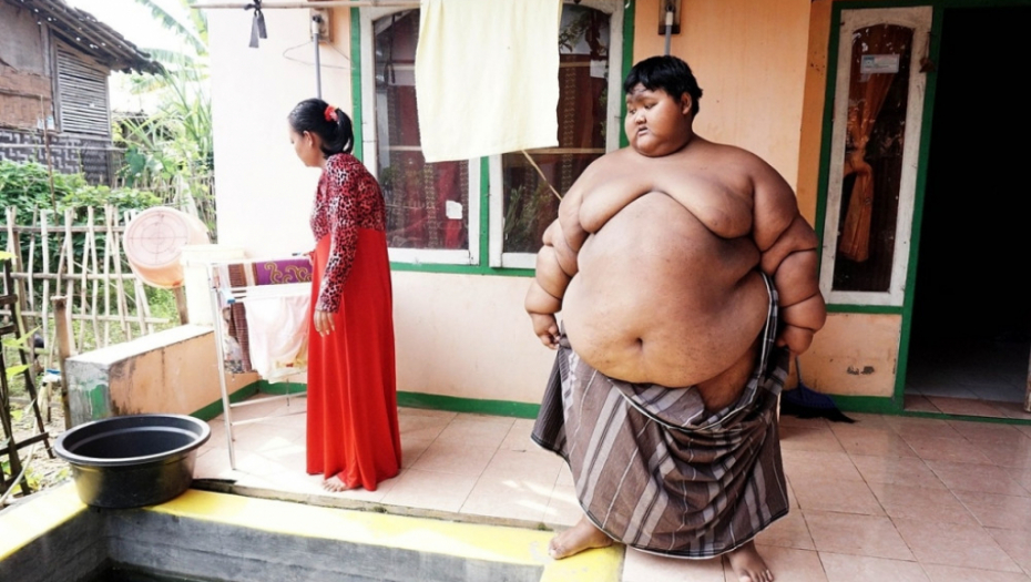 Arja, najdeblji dečak na svetu