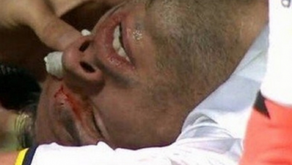 Horor povreda Van Persija