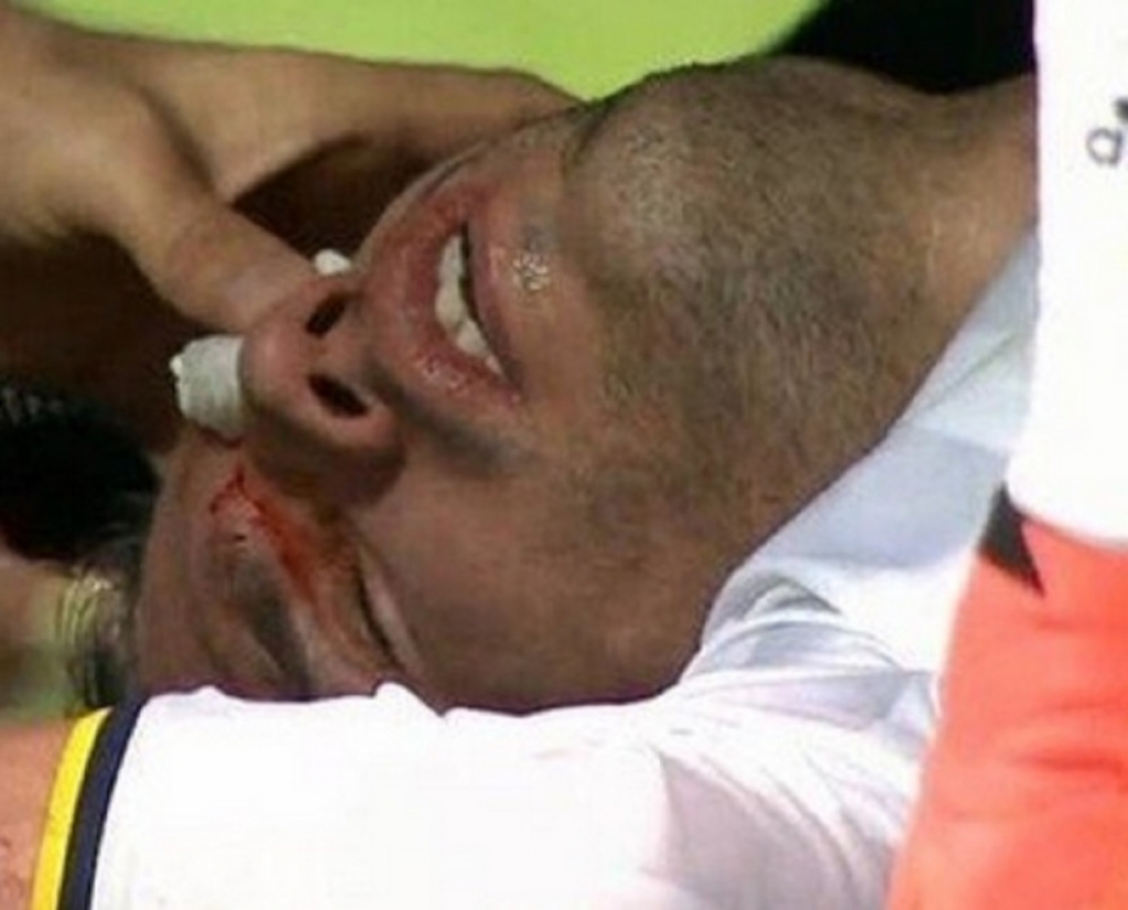 Horor povreda Van Persija