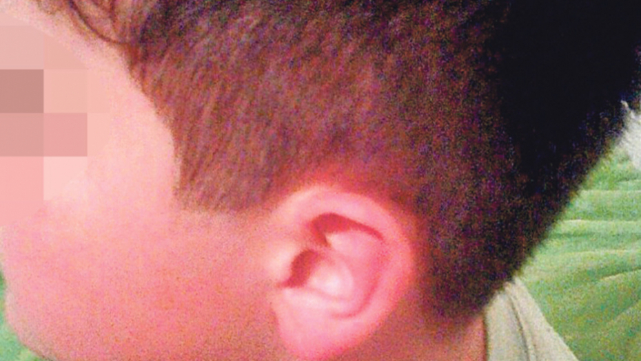 Ne može da spava od bolova u ušima: M. P. (11) 