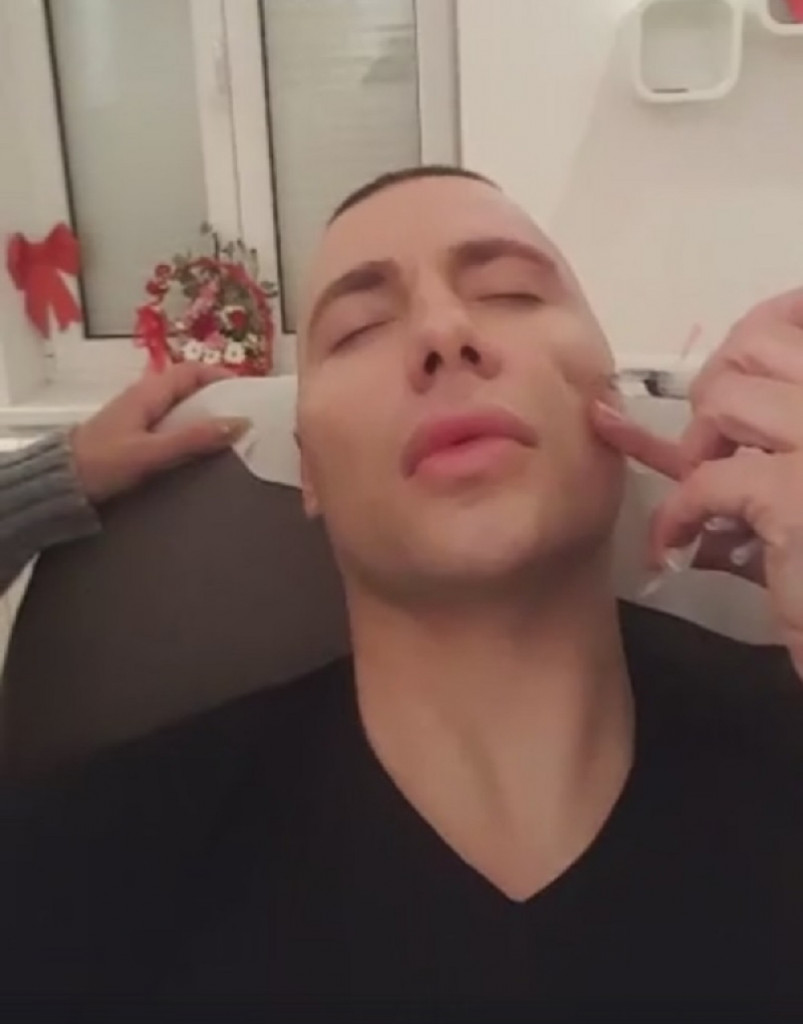 Brendon ne može bez silikona