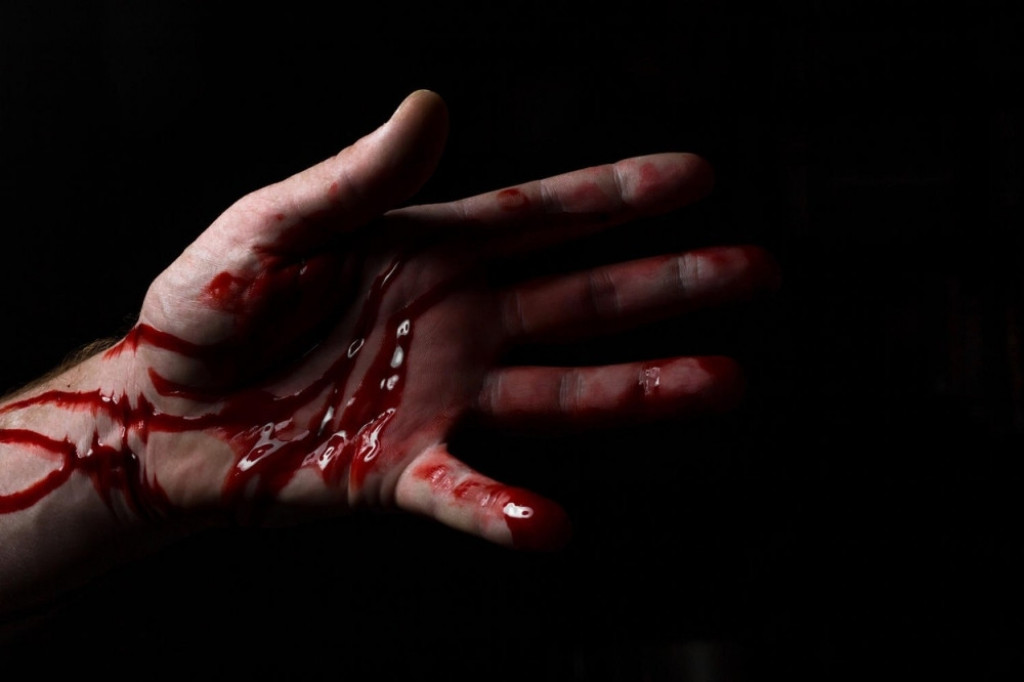 Krv tuča šaka pesnica posekotina ruka izboden nož izbosti