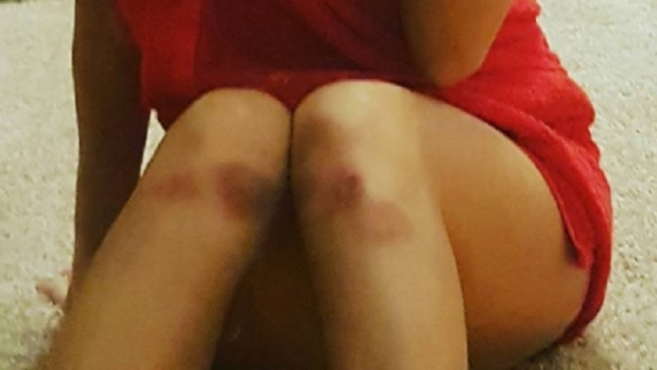 Kolena Nives Celzijus