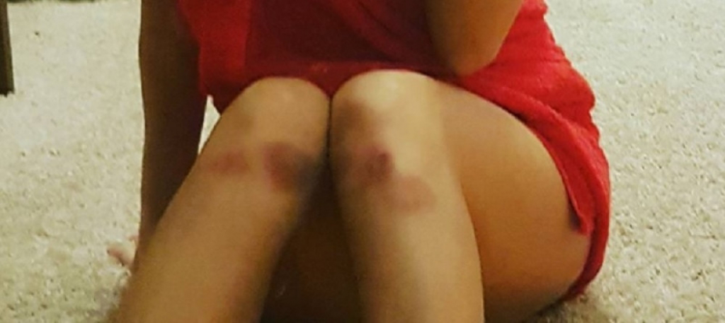 Kolena Nives Celzijus