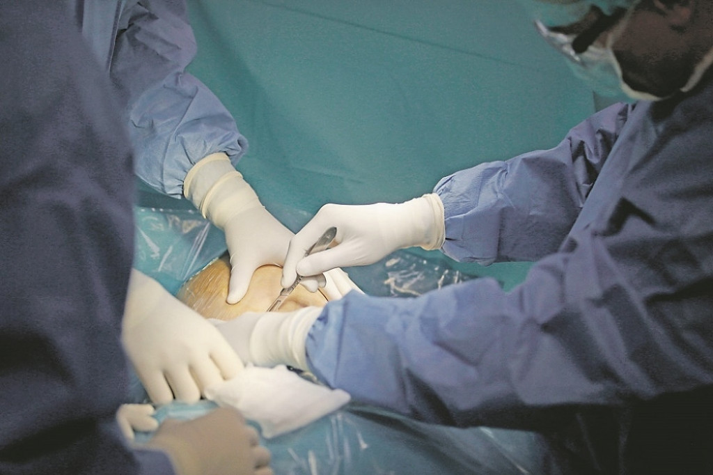 Carski rez, operacija, porođaj