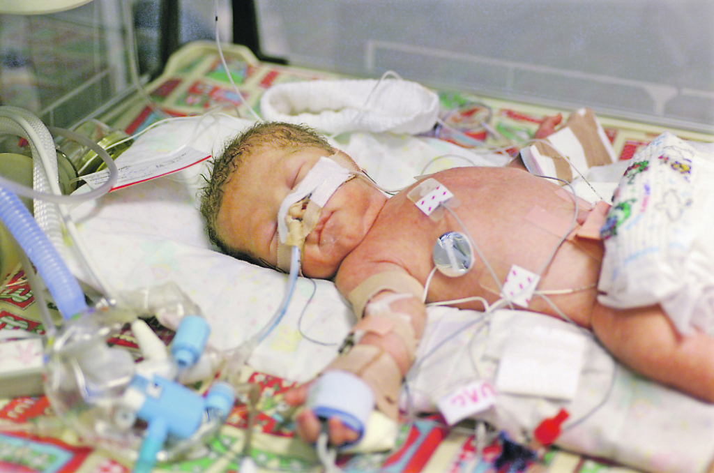 Beba prevremeno rođena beba