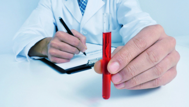 Krv krvna grupa transfuzija davanje krvi laboratorija analize