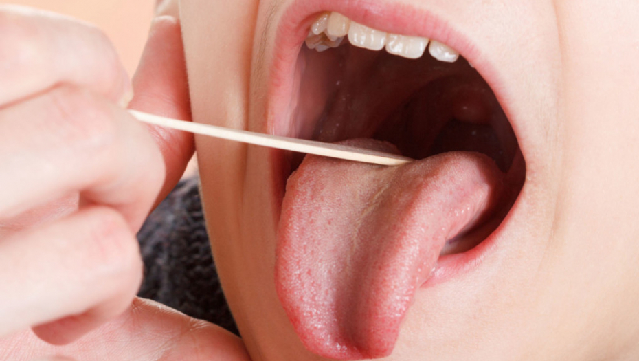 Prehlada grip bolest temperatura kijanje kašalj bronhitis