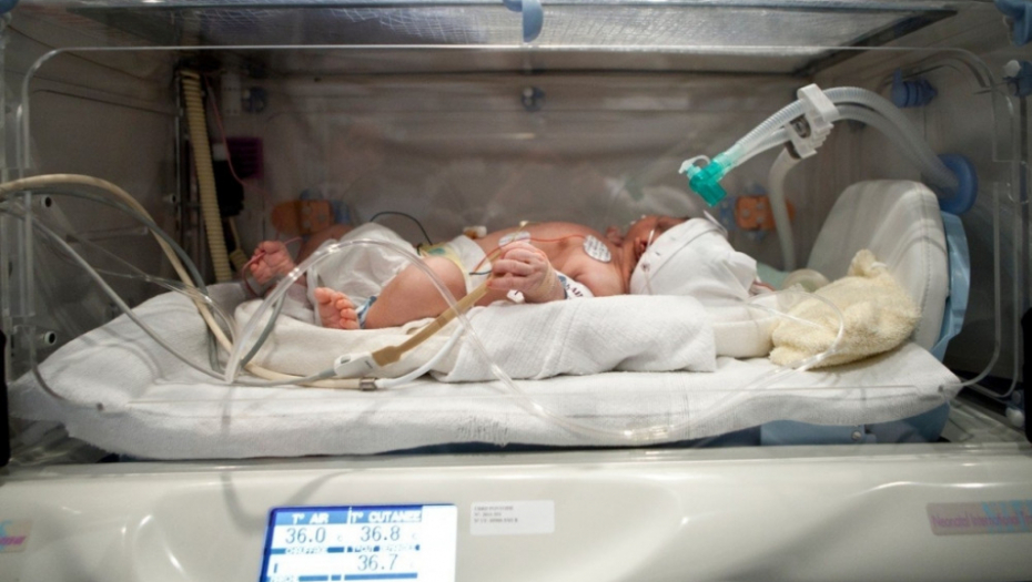Prevremeno rođena beba inkubator