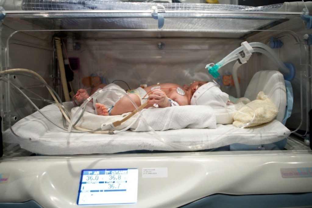 Prevremeno rođena beba inkubator