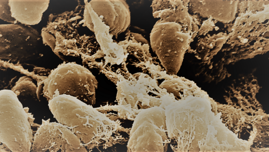 Bakterija koja izaziva KUGU