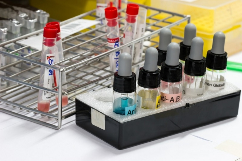 Krv, krvna slika, analize