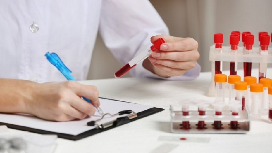 Krv, krvna slika, analize