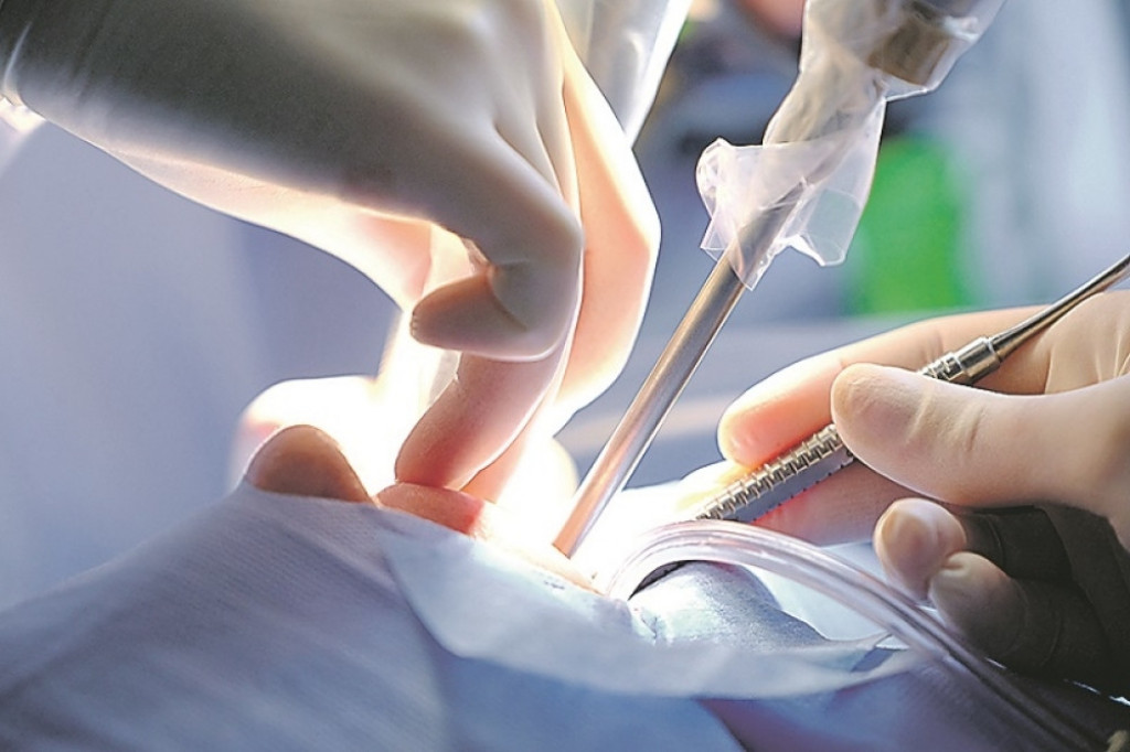 Operaciju izveo vrhunski tim lekara