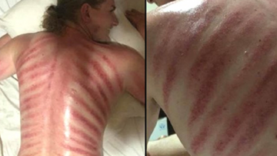 Masaža &quot;Crveni zmaj&quot;