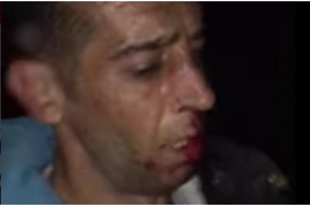 Prebijanje migranata