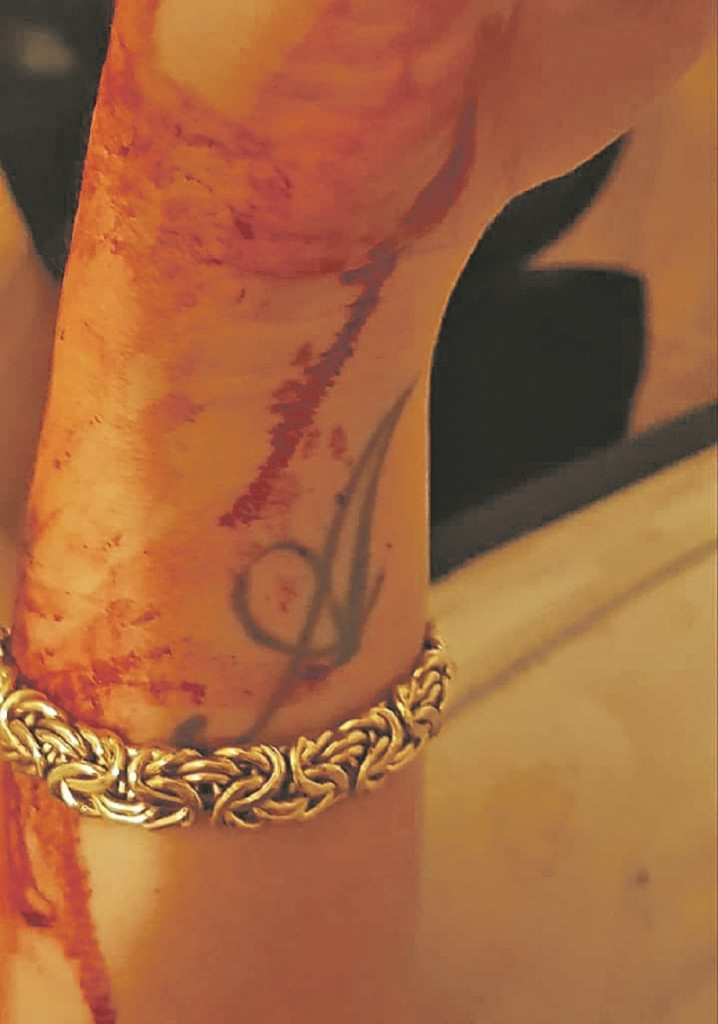 Napasnik porno - glumici isekao ruku