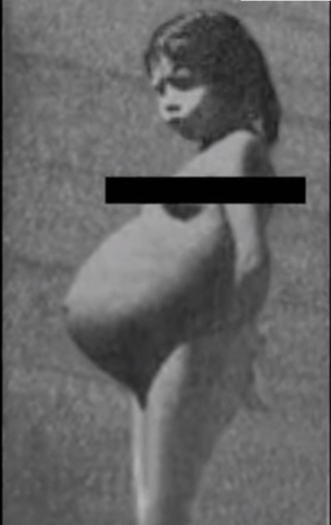 Lina Medina