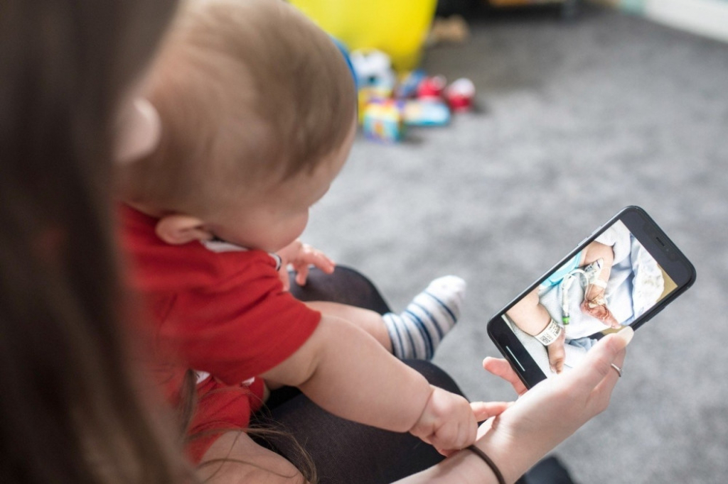 Noa Tindl, beba sa herpesom