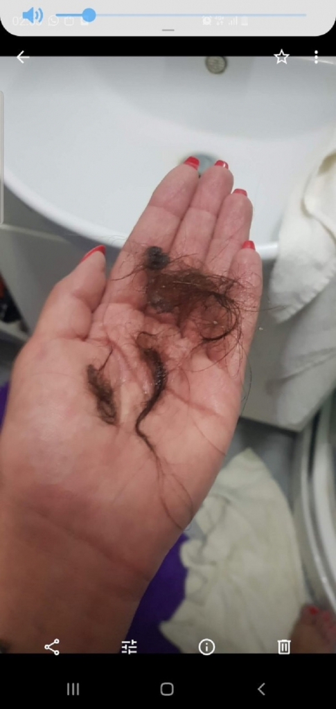 Saneli opada kosa posle prebijanja