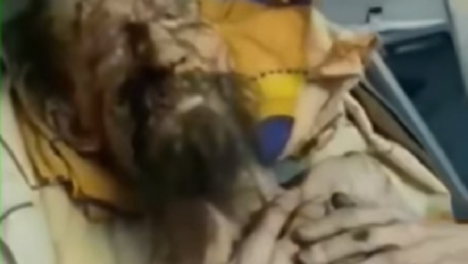 Aleksandar, žrtva medveda