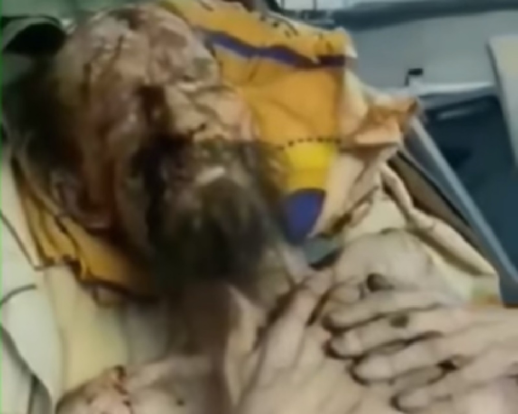 Aleksandar, žrtva medveda